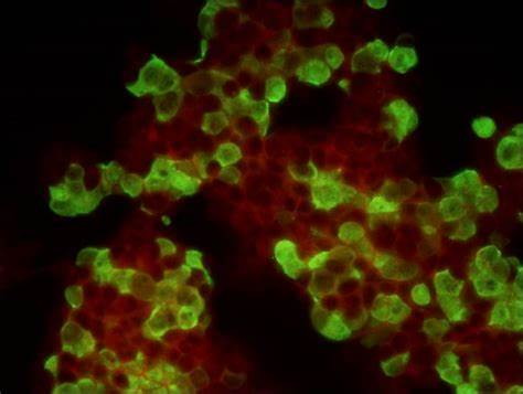 疾控中心病毒實驗室的顯微鏡應用